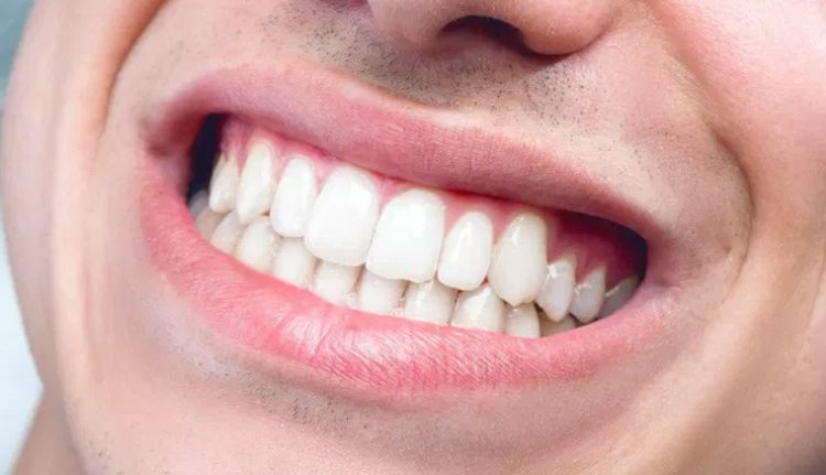 बड़ा खुलासा : तो अब आपके बत्तीसी यानी 32 दांत की जगह 28 ही होंगे, पढ़ें क्या है कारण !